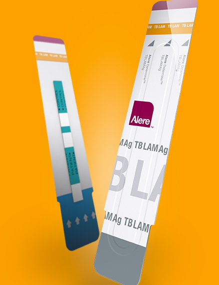 Alere Determine TB LAM Ag